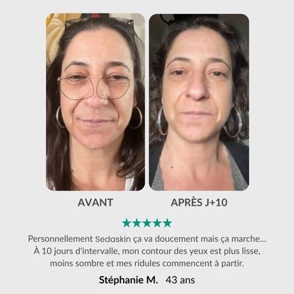 Soin Complet du Regard : Stylo Activateur