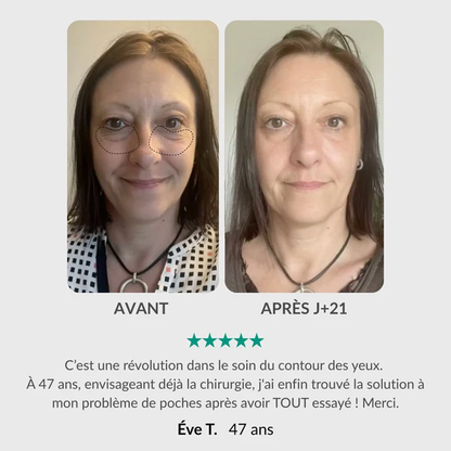 Soin Complet du Regard : Stylo Activateur