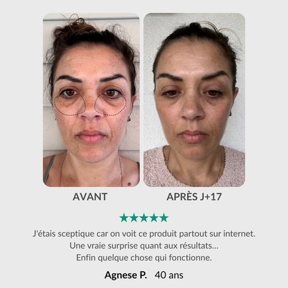 Soin Complet du Regard : Stylo Activateur